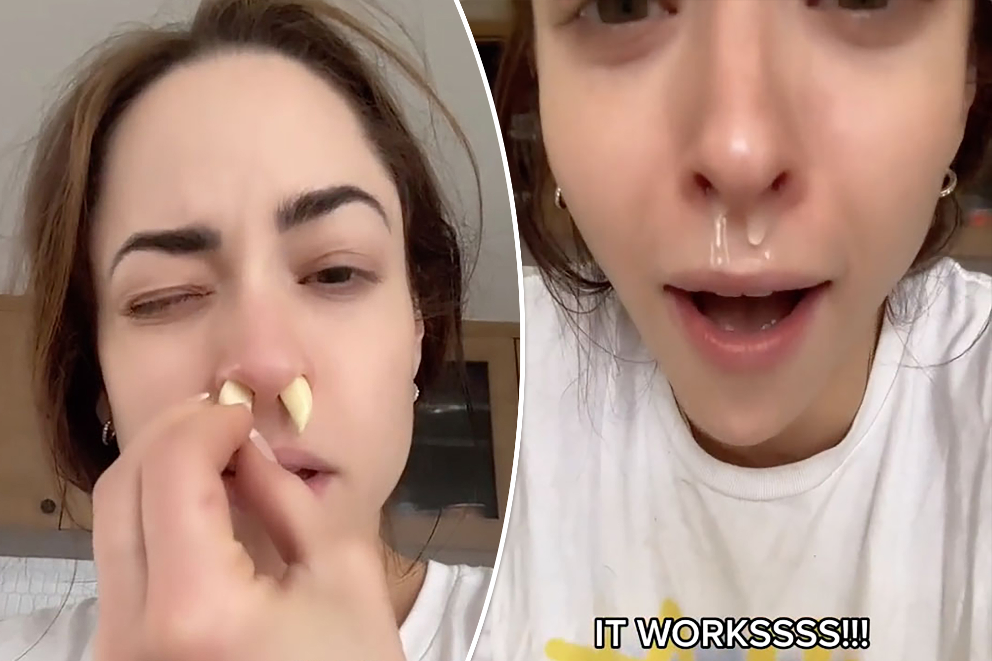 Effective Ways to Know If Your Wisdom Teeth Are Emerging in 2025