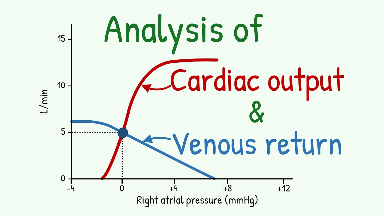 Effective Ways to Calculate Cardiac Output: A Complete Guide for 2025