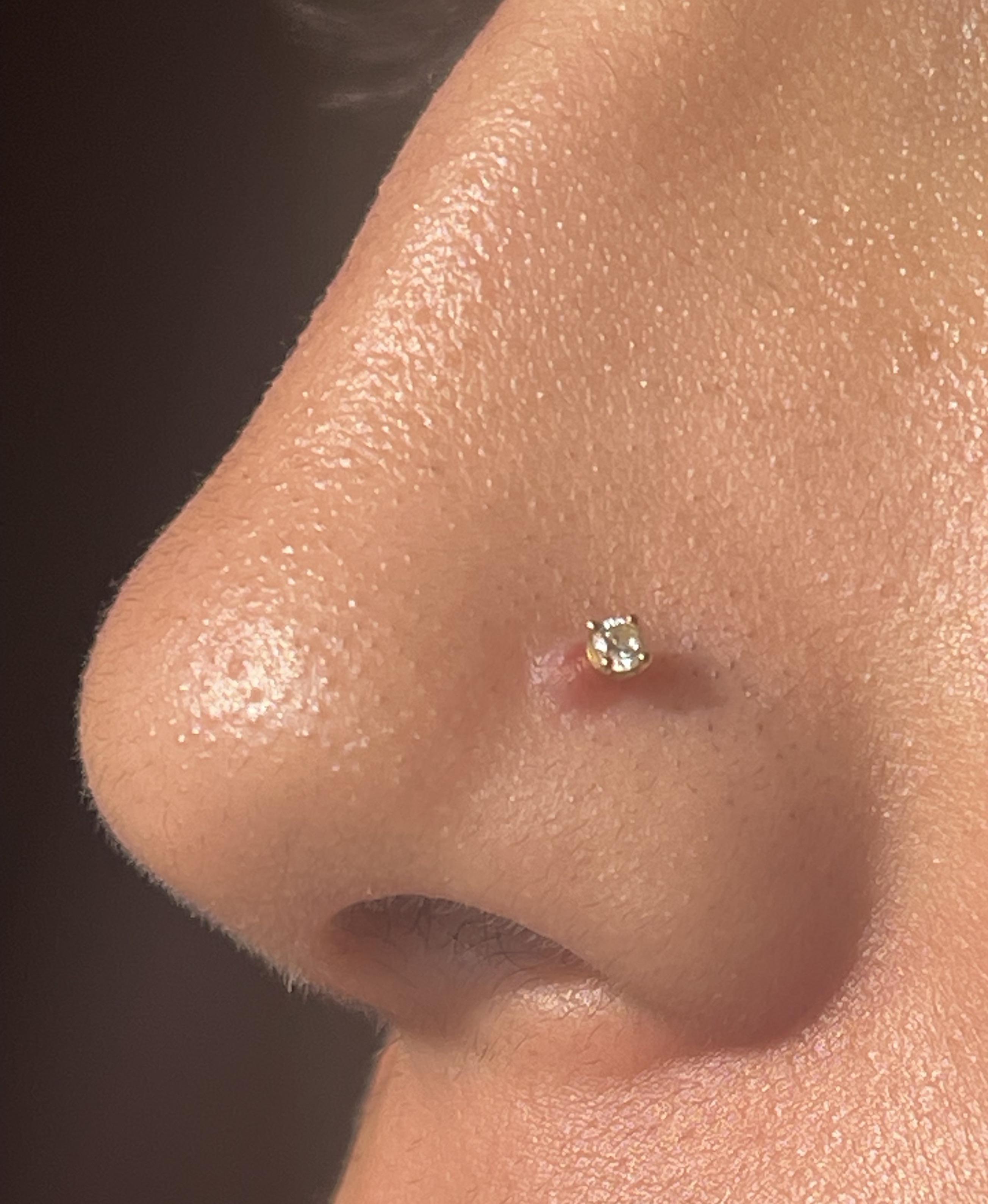 Natural Remedies for Piercing Bumps