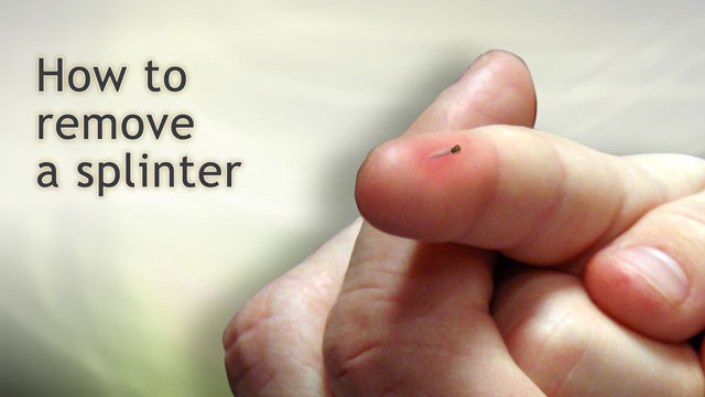 How to remove splinter you can’t see