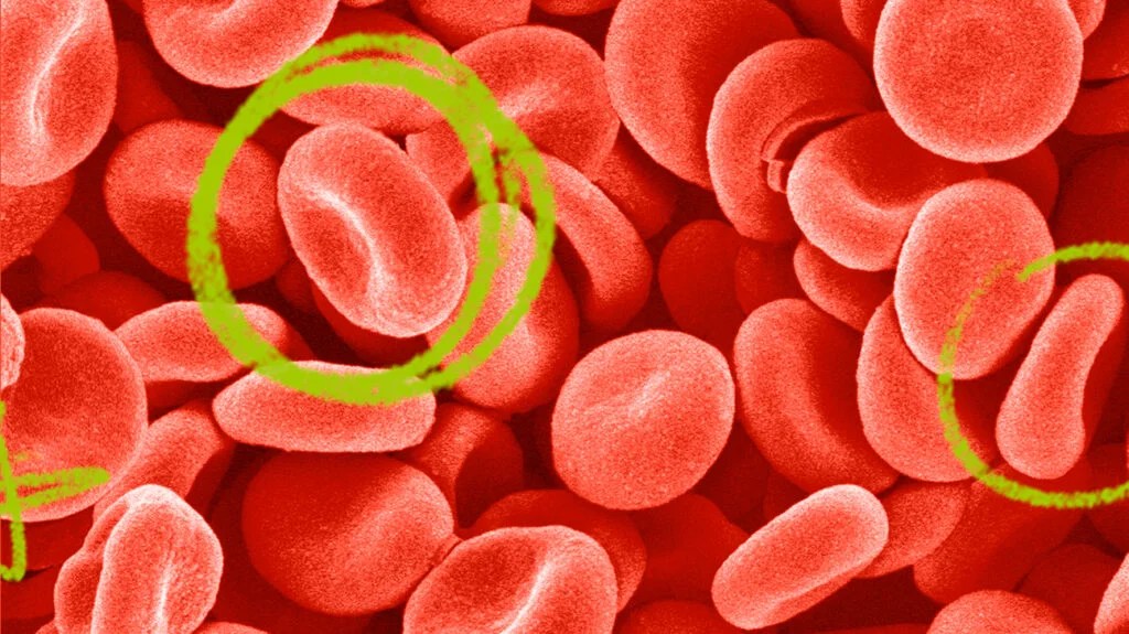 Ways to Increase Hemoglobin Levels